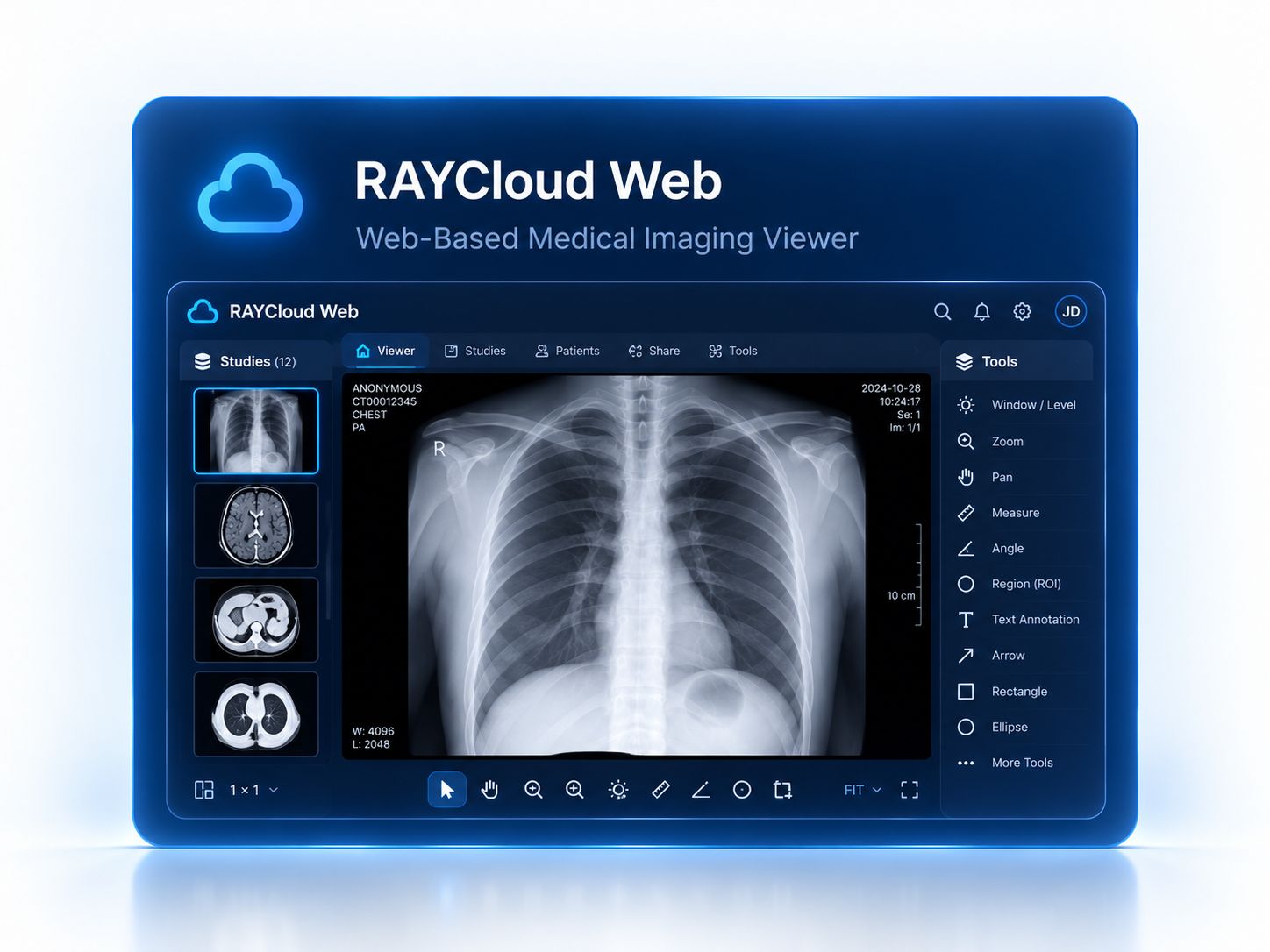 RAYCloud Web — View medical images in the browser (screen for reference only).